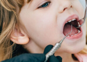 ילדה במהלך טיפול אצל רופא שינים